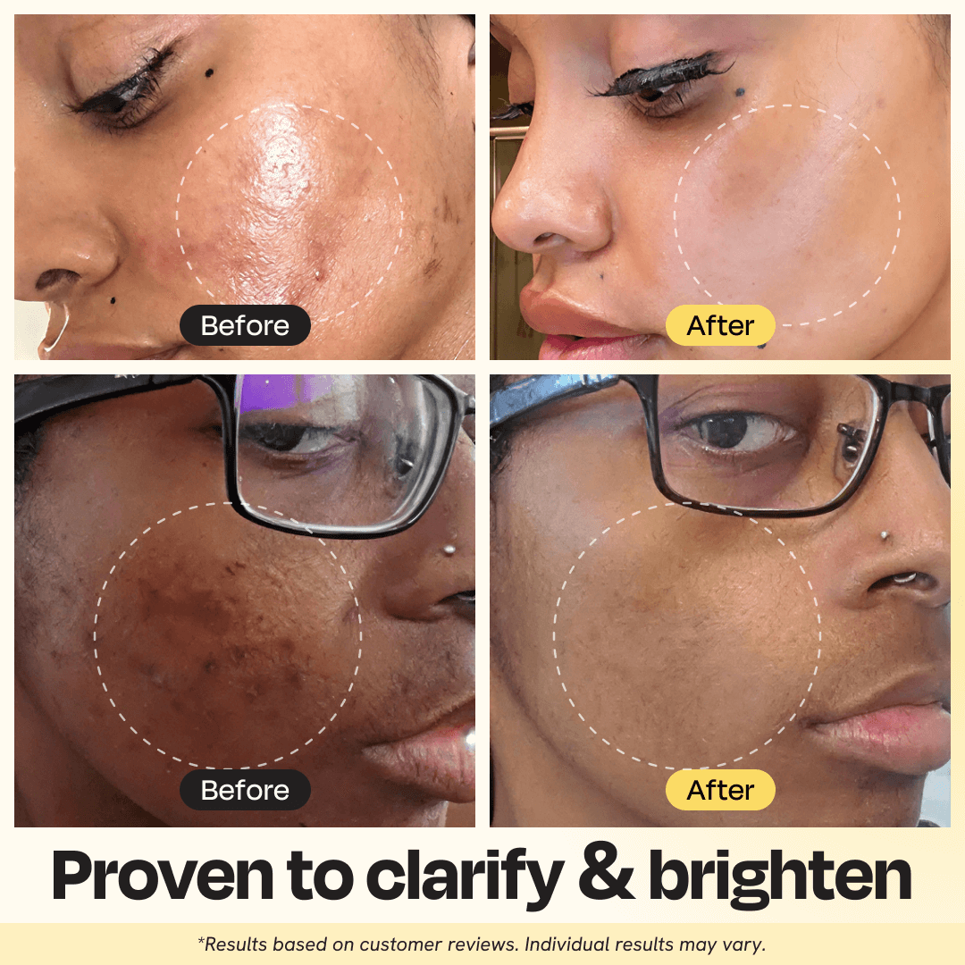 Vitamin C Clay Mask - Clear your face