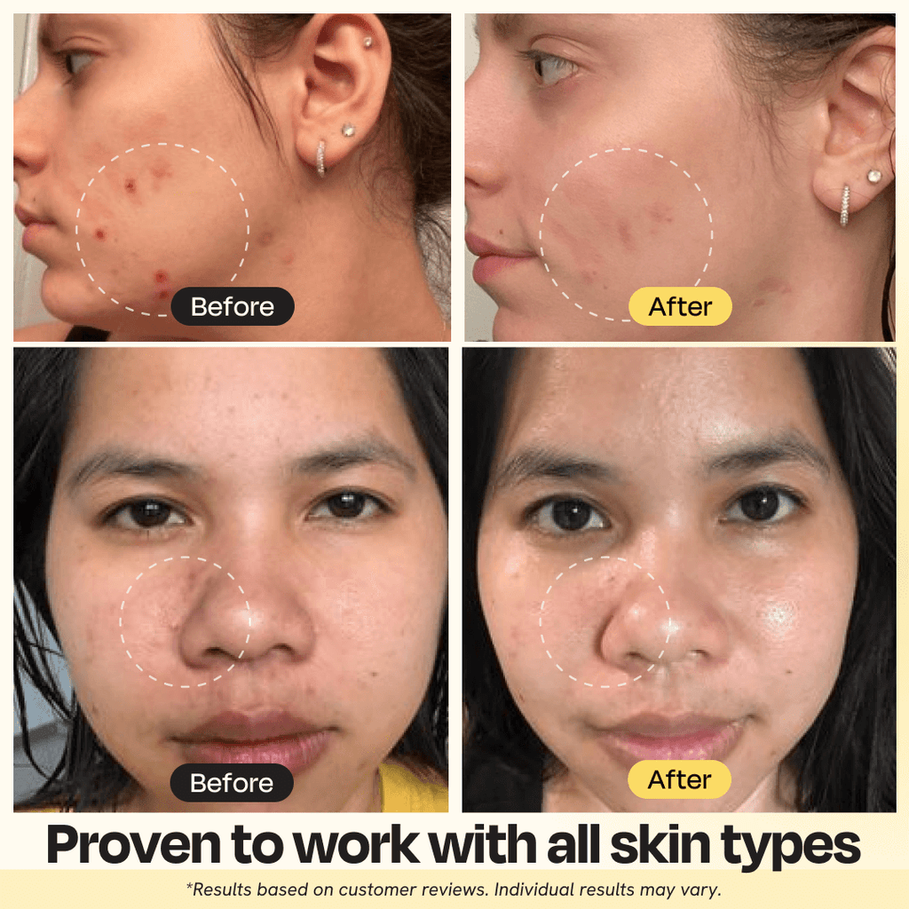 Vitamin C Clay Mask - Clear your face